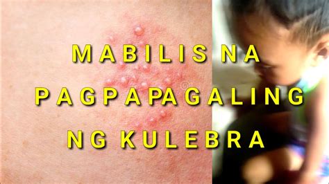 sanhi ng kulibrang apoy|Uri ng mabahong hininga may katumbas na sakit .